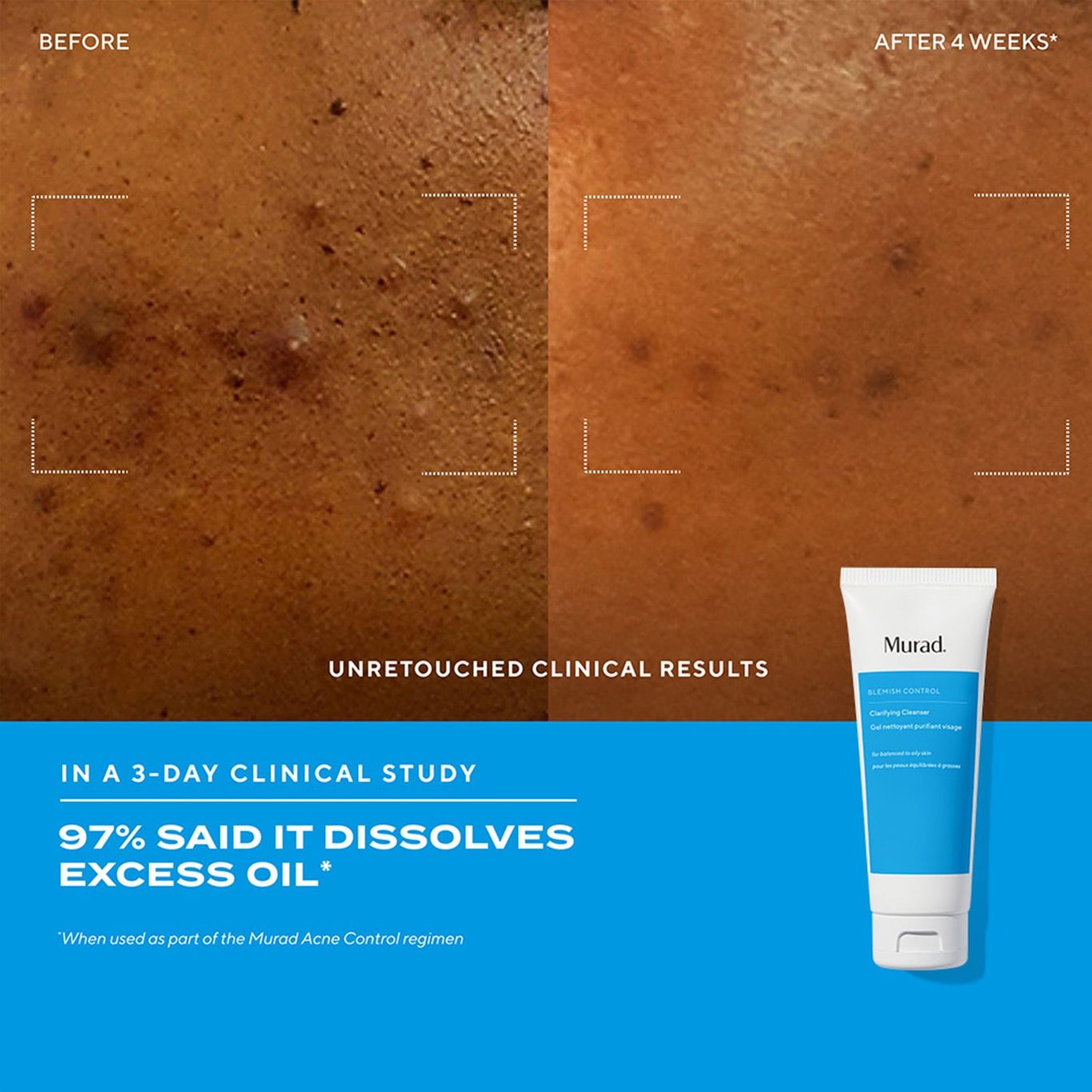 Miniatyrbilde